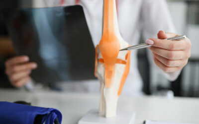 Arthrose du genou : quand opérer pour poser une prothèse ?